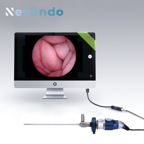 Telecamera endoscopio