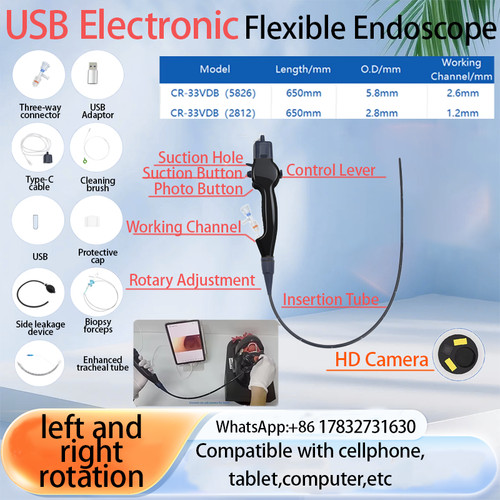 Endoscopio flessibile - endoscopio,