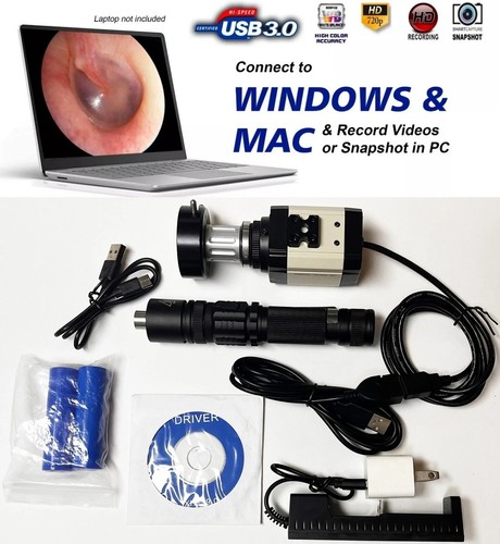 Endoscopio rigido cistoscopio