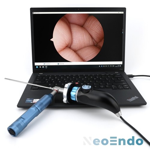 Telecamera endoscopio usb - endoscopio,